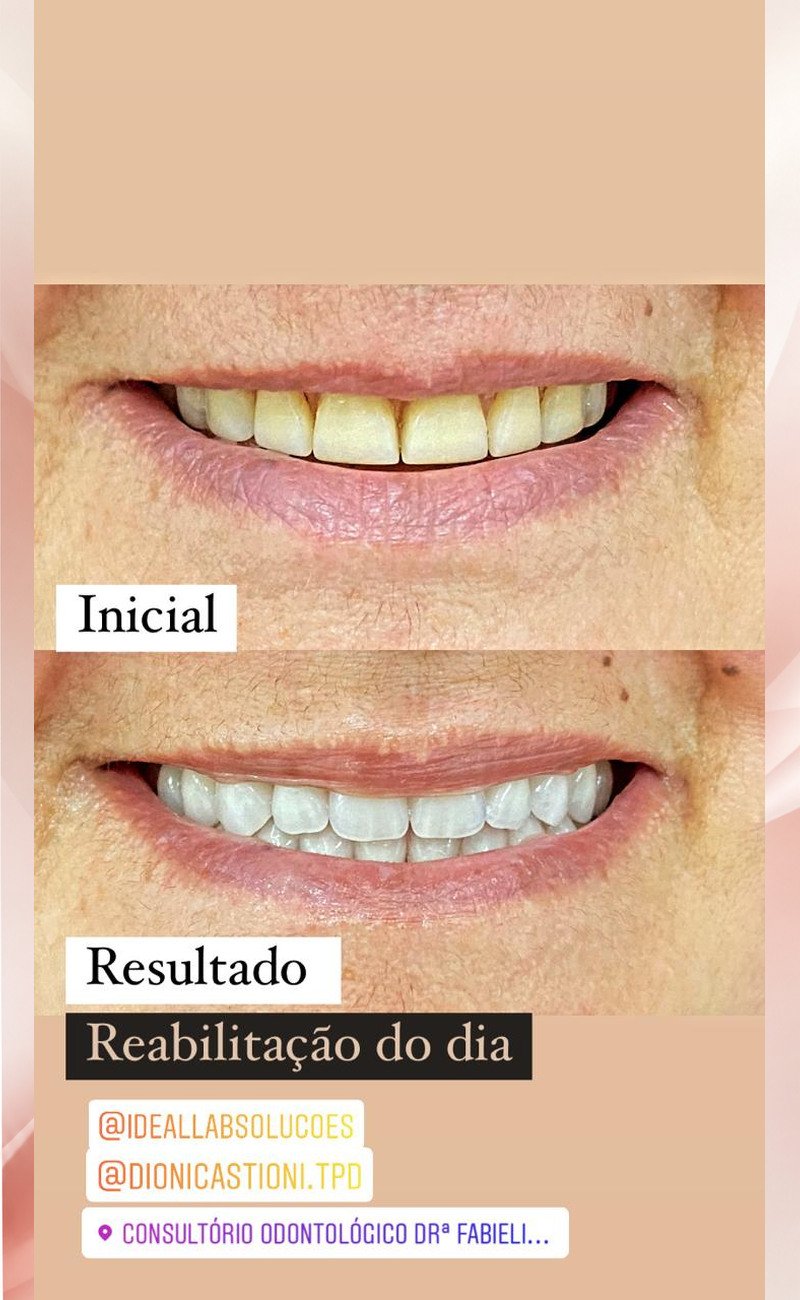 01-reabilitacao-odontologica