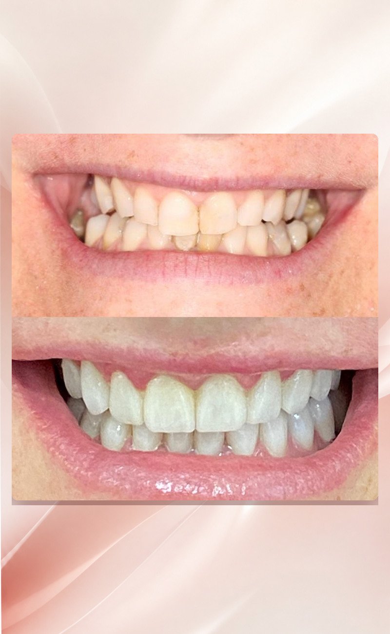 02-transformacao-do-sorriso