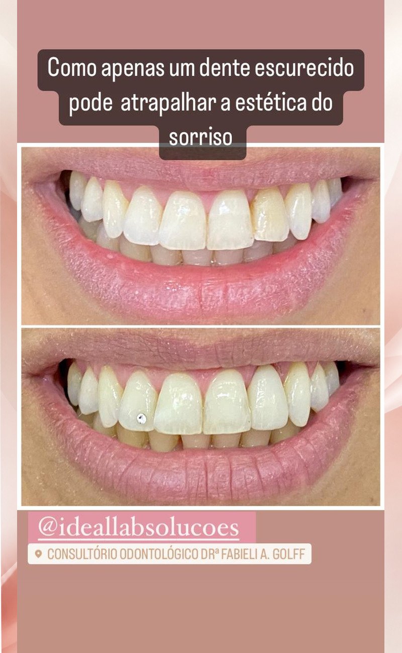 09-estetica-do-sorriso